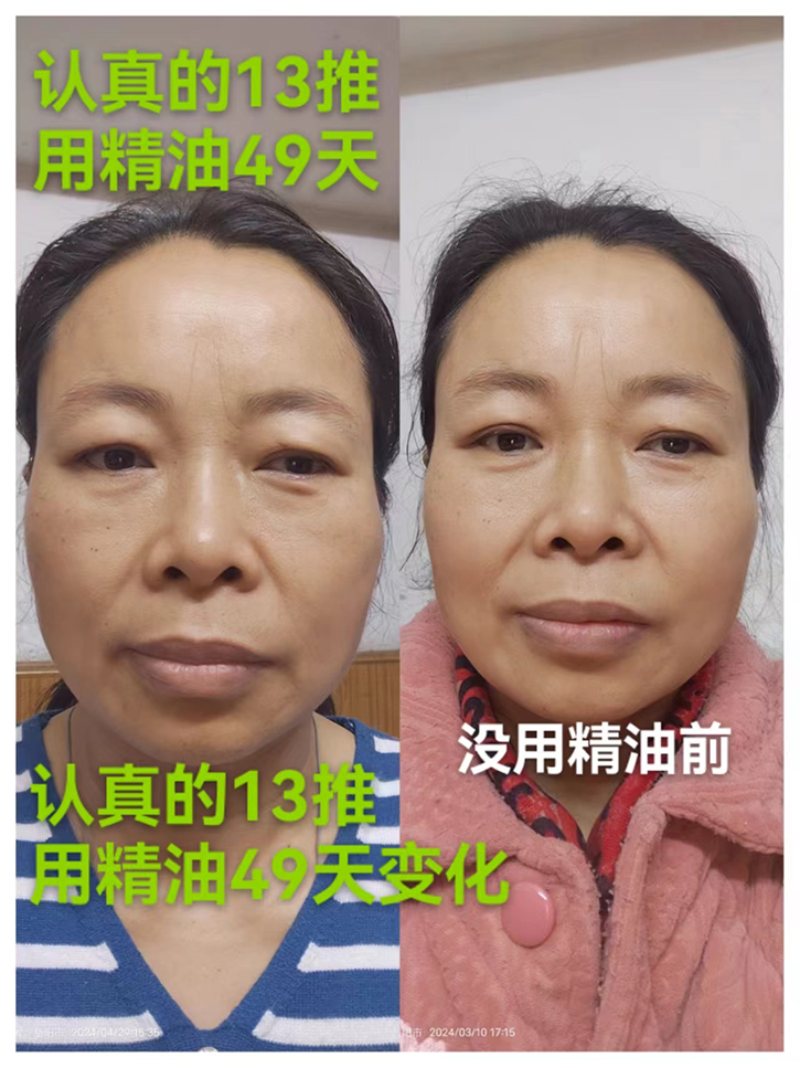 群友分享結緣十三推+用四季精油套裝49天后的喜悅心情！——年輕了，精神狀態(tài)好了！調理好幾年來的病痛！